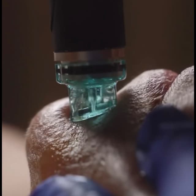 Hydrafacial Package at The Layer & The Spell by Rexstyles in Point Pleasant Beach, NJ